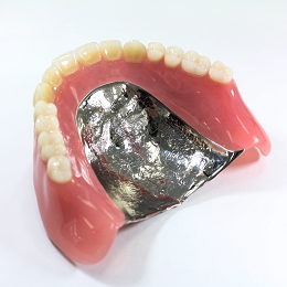 metaldenture